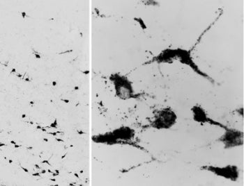 IHC testing of a PFA-perfused cryosection of human hypothalamus with Oxytocin antibody at 0.05ug/ml.