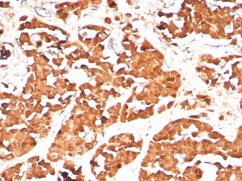 Growth Hormone Antibody / GH1