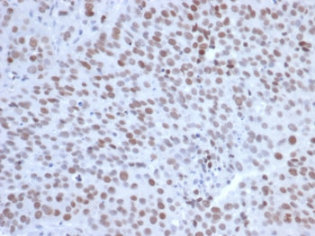 IHC staining of FFPE human tonsil tissue with EZH2 antibody (clone EZH2/6991). HIER: boil tissue sec