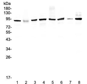 Western blot testing of human 1) HeLa 2) placenta, 3) MCF7, 4) A549, 5) SK-OV-3, 6) 22RV1, 7) A431 a