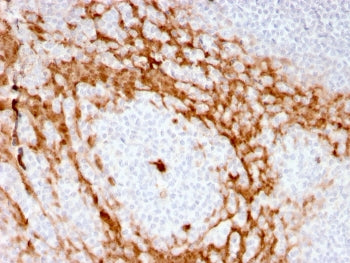 IHC staining of FFPE human tonsil with recombinant GCSF antibody (clone CSF3/3166R). HIER: boil tiss