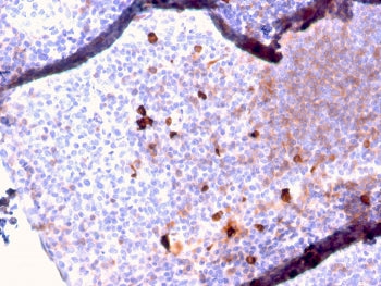 IHC staining of FFPE human tonsil with recombinant IgM antibody (clone IGHM/2557R). HIER: boil tissu