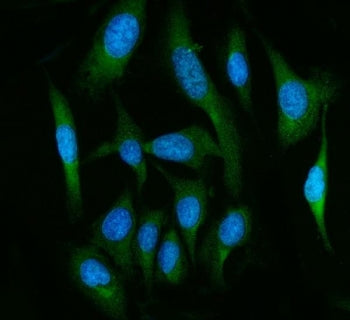 Immunofluorescent staining of FFPE human U-2 OS cells with Fatty-acid amide hydrolase 1 antibody (gr