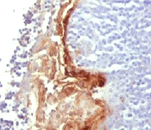 Involucrin Antibody