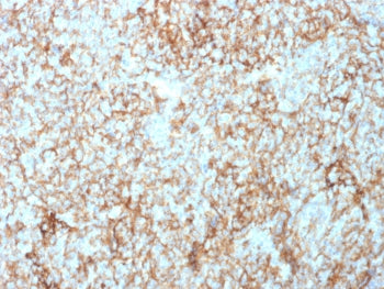 IHC staining of FFPE human tonsil tissue with CD73 antibody (clone NT5E/2503). HIER: boil tissue sec