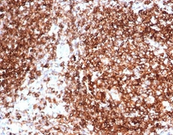 Pan-HLA Antibody MHC II (DP/DQ/DR)