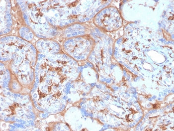 PD-L1 Antibody / B7-H1 / CD274