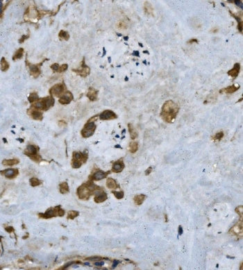 IHC staining of FFPE human placenta with FGA antibody. HIER: boil tissue sections in pH8 EDTA for 20