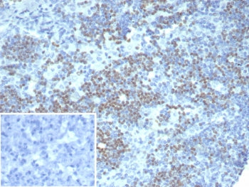 IHC staining of FFPE human lymph node tissue with PAX3 antibody (clone PAX3/8426). Inset: PBS used i
