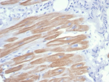 IHC staining of FFPE human heart muscle tissue with recombinant ACTN2 antibody (clone rACTN2/7361). 
