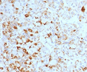 Luteinizing Hormone beta Antibody