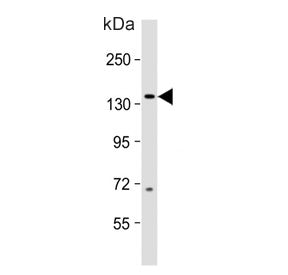 Western blot testing of human fetal brain lysate with MAP3K15 antibody. Predicted molecular weight ~