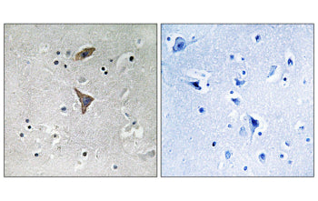 IHC staining of FFPE human brain tissue with KCNT1 antibody (left) and negative control (right). HIE