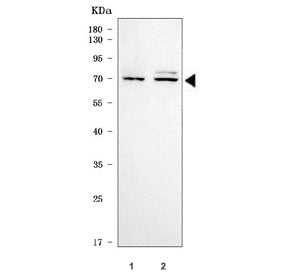Western blot testing of human 1) MOLT4 and 2) Daudi cell lysate with CAT-3 antibody. Predicted molec