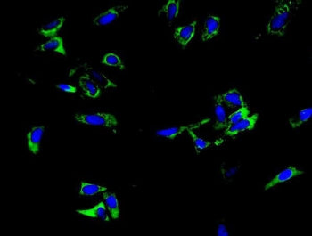 TRIM6 Antibody