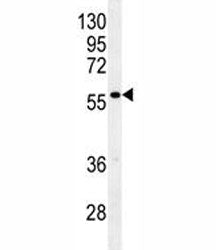 Glypican 3 antibody western blot analysis in mouse stomach tissue lysate