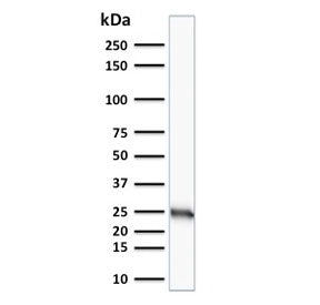 Bcl-2 Antibody