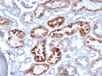 Retinol Binding Protein 4 Antibody / RBP4