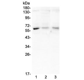 Western blot testing of human 1) A375, 2) A549 and 3) SMMC-7721 lysate with ARSA antibdoy at 0.5ug/m