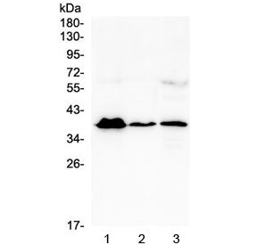 Western blot testing of human 1) T-47D, 2) U937 and 3) A431 cell lysate with MR1 antibody at 0.5ug/m