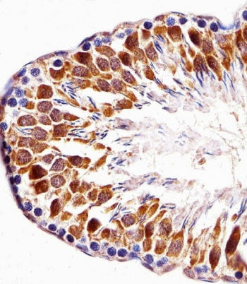 IHC testing of FFPE rat testis tissue with TOPK antibody. HIER: steam section in pH6 citrate buffer 