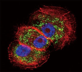 Confocal immunofluorescent analysis of Parkin antibody with NCI-H460 cells followed by Alexa Fluor 4