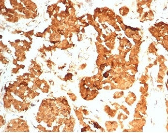 IHC staining of FFPE human pituitary gland tissue with HCG-beta antibody (clone HCGb/7201R). HIER: b