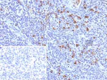 IHC staining of FFPE human tonsil tissue with IGLV1-51 antibody (clone IGLC1/9475). Inset: PBS used 