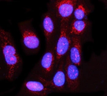 MIS12 Antibody
