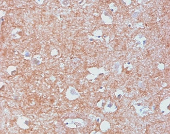 IHC staining of human cerebellum with recombinant NF-L antibody (clone MSI27-2R). HIER: boil tissue 