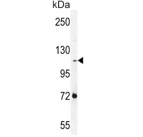 Western blot testing of human NCI-H460 cell lysate with Protocadherin alpha-C2 antibody. Predicted m