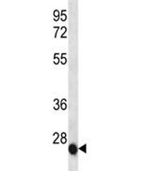 IL-6 Antibody, 0.08ml
