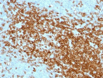 CD43 Antibody