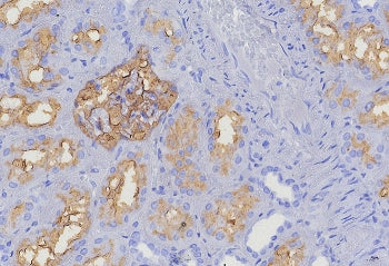 CD10 Antibody / Neprilysin