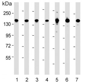 Western blot testing of 1) human PANC-1, 2) human HeLa, 3) human Jurkat, 4) mouse NIH 3T3, 5) human 