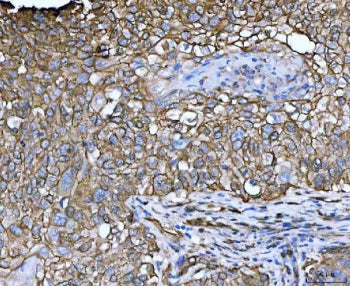 LIMA1 Antibody / EPLIN