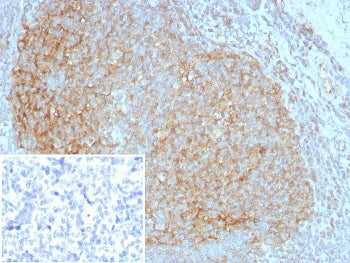 IHC staining of FFPE human tonsil tissue with CD35 antibody (clone CR1/8283R). Inset: PBS used in pl