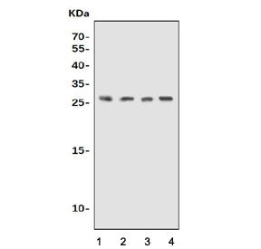 Western blot testing of 1) human K562, 2) human SK-OV-3, 3) rat stomach and 4) mouse stomach lysate 