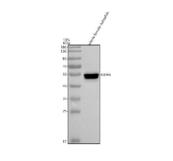 Western blot analysis of Ddx6 protein using Zebrafish Ddx6 antibody and whole female zebrafish tissu