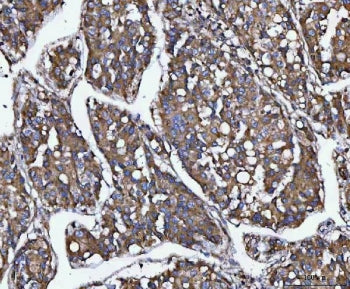 MIA3 Antibody / TANGO1