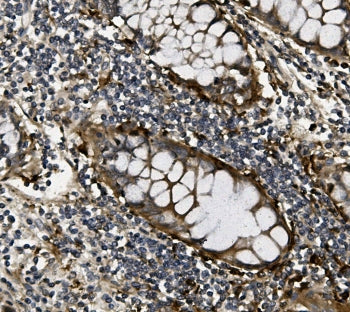 VEGF Antibody