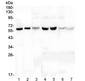 Western blot testing of 1) human HeLa, 2) human U-2 OS, 3) human U-87 MG, 4) rat liver, 5) rat kidne