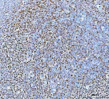 IHC staining of FFPE human chronic tonsillitis tissue with B-cell lymphoma/leukemia 11B antibody. HI