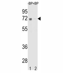 Western blot analysis of ER antibody pre-incubated without (Lane 1) and with (2) blocking peptide in