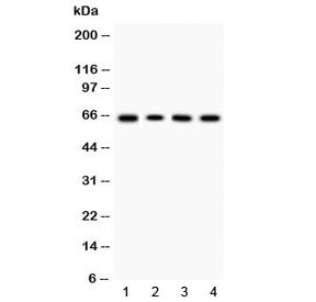 Western blot testing of 1) rat thymus, 2) mouse thymus, 3) human HeLa and 4) human K562 lysate with 