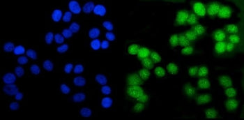 Androgen Receptor Antibody