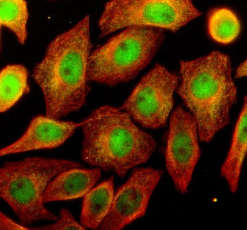 Immunofluorescent staining of OSTM1 using anti-OSTM1 antibody (green) and anti-Beta Tubulin antibody