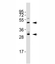 Shh Antibody / Sonic Hedgehog