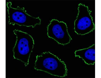 Fluorescent image of A549 cell stained with CD33 antibody at 1:25. CD33 immunoreactivity is localize