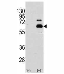 Western blot analysis of p70 S6 Kinase antibody and 293 cell lysate (2 ug/lane) either nontransfecte